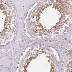 TBC1D9 Antibody, Novus Biologicals:Antibodies:Primary Antibodies